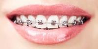 Clear Smiles Orthodontics image 1